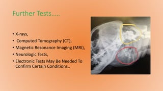 Further Tests…..
• X-rays,
• Computed Tomography (CT),
• Magnetic Resonance Imaging (MRI),
• Neurologic Tests,
• Electronic Tests May Be Needed To
Confirm Certain Conditions,.
 