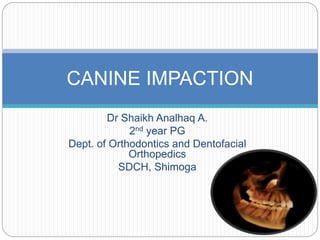 Dr Shaikh Analhaq A.
2nd year PG
Dept. of Orthodontics and Dentofacial
Orthopedics
SDCH, Shimoga
CANINE IMPACTION
 