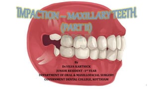 By
Dr.VILVA KARTHICK
JUNIOR RESIDENT -1st YEAR
DEPARTMENT OF ORAL & MAXILLOFACIAL SURGERY
GOVERNMENT DENTAL COLLEGE, KOTTAYAM
1
 