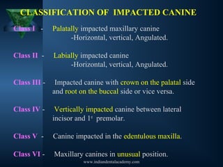 Canine impaction 1