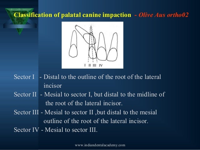impacted tooth