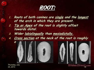 Root:
1. Roots of both canines are single and the longest
of the arch in which they are present.
2. Tip or Apex of the root is slightly offset
towards distal.
3. Wider labiolingually than mesiodistally.
4. Cross section at the neck of the root is roughly
ovoid.
Thursday, July
25, 2013 18
 