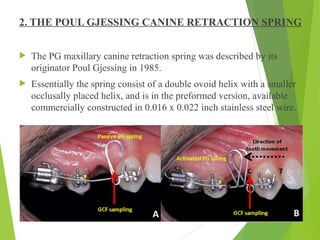 Comprehensive Overview of Canine Retraction in Orthodontics ...