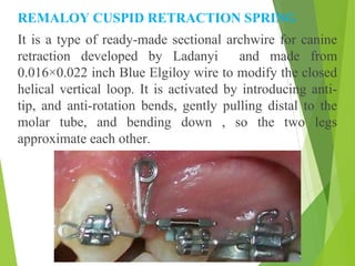 Comprehensive Overview of Canine Retraction in Orthodontics ...