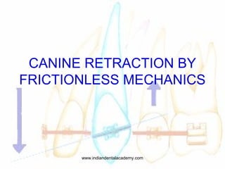 CANINE RETRACTION BY
FRICTIONLESS MECHANICS
www.indiandentalacademy.com
 