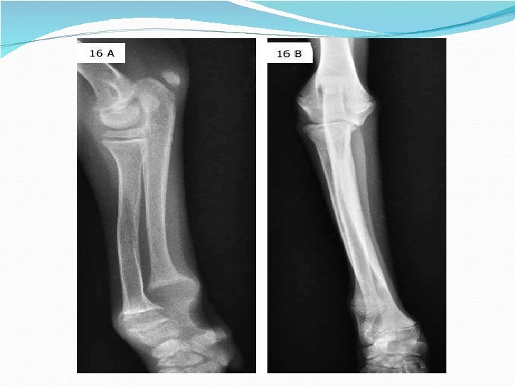 Canine Rickets