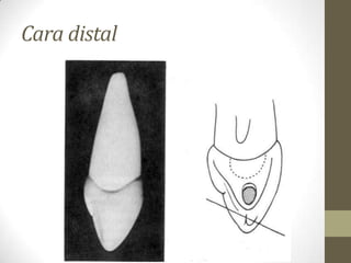 Cara distal
 