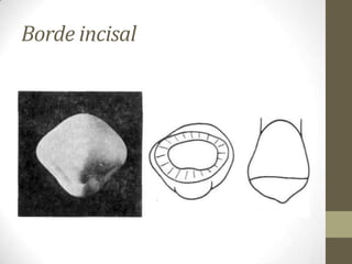 Borde incisal
 