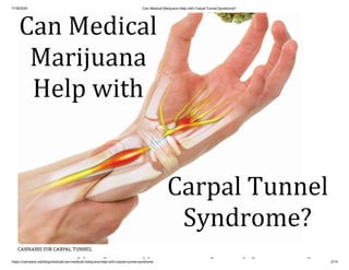Does Medical Cannabis Help with Carpal Tunnel Syndrome?