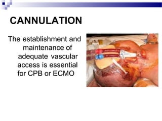 CANNULATION
The establishment and
maintenance of
adequate vascular
access is essential
for CPB or ECMO
 