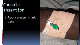 Cannula
Insertion
 Apply plaster, mark
date
 