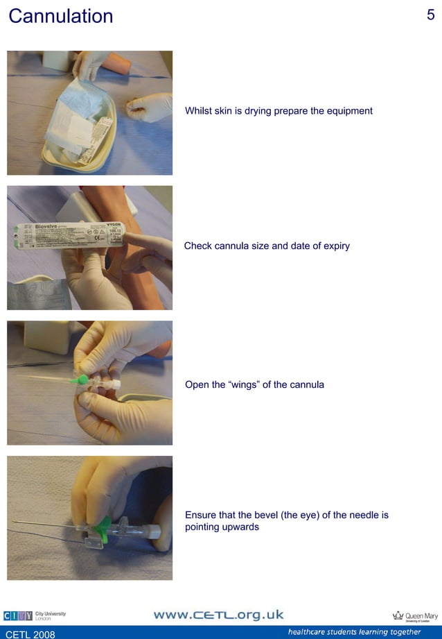 Cannulation venepuncture print | PDF | Blood Disorders | Diseases and ...