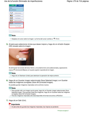 Uso de la función Eliminador de imperfecciones                                                        Página 179 de 716 páginas




         Nota
         Desplace el cursor sobre la imagen. La forma del cursor cambia a         (Cruz).



  5. Arrastre para seleccionar el área que desee mejorar y haga clic en el botón Aceptar
     (OK) situado sobre la imagen.




     Se eliminarán los lunares del área interior y circundante de la zona seleccionada y aparecerá la
     marca     (Corrección/Mejora) en la parte superior izquierda de la imagen.

         Nota
         Haga clic en Deshacer (Undo) para deshacer la operación de mejora anterior.


  6. Haga clic en Guardar imagen seleccionada (Save Selected Image) o en Guardar
     todas las imágenes corregidas (Save All Corrected Images).
     Es posible guardar imágenes mejoradas como archivos nuevos.

         Nota
         Para guardar sólo una imagen que le guste, haga clic en Guardar imagen seleccionada (Save
         Selected Image). Para guardar todas las imágenes, haga clic en Guardar todas las imágenes
         corregidas (Save All Corrected Images).
         Para las imágenes mejoradas sólo está disponible el formato de archivo JPEG/Exif.


  7. Haga clic en Salir (Exit).
        Importante
         Si sale antes de guardar las imágenes mejoradas, las mejoras se perderán.

                                                                                     Principio de página
 