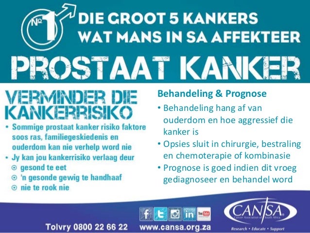 Binêre opsies gebaseer in die VSA