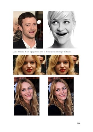 363 
Até a diferença de um espaçamento entre os dentes causa diminuição da beleza 
 