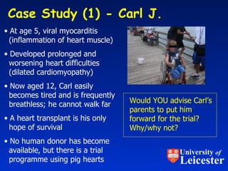 Case Study (1) - Carl J.  At age 5, viral myocarditis   (inflammation of heart muscle) Developed prolonged and   worsening heart difficulties   (dilated cardiomyopathy) Now aged 12, Carl easily   becomes tired and is frequently   breathless; he cannot walk far A heart transplant is his only   hope of survival No human donor has become   available, but there is a trial   programme using pig hearts Would YOU advise Carl’s parents to put him forward for the trial?  Why/why not? University  of Leicester 