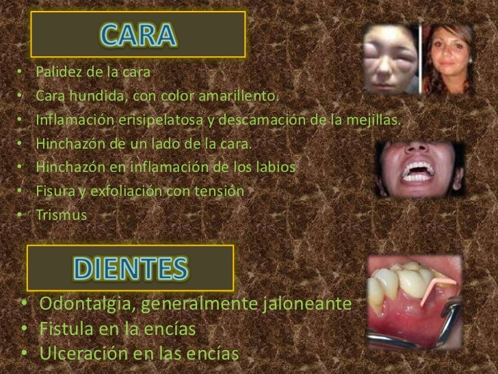 El dolor agudo en la espalda los pies