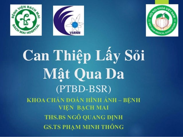 Can Thiep Lay Soi Mat Qua Da