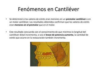Fenómenos en Cantiléver
• Se determinó si los valores de estrés eran menores en un premolar cantiléver o en
un molar cantiléver. Los resultados obtenidos confirman que los valores de estrés
eran menores en el premolar que en el molar.
• Este resultado concuerda con el conocimiento de que mientras la longitud del
cantiléver distal incrementa, o sea el brazo de potencia aumenta, la cantidad de
estrés que ocurre en la restauración también incrementa.
 