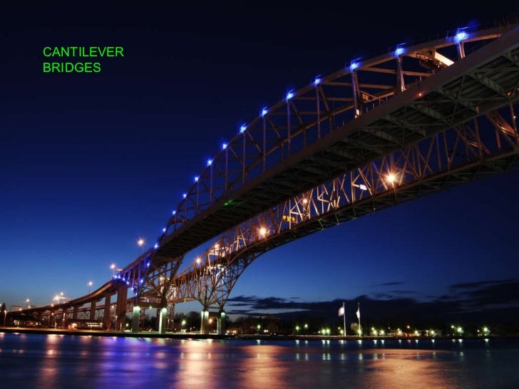 cantilever bridge dental