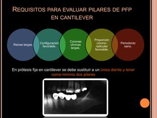 REQUISITOS PARA EVALUAR PILARES DE PFP
EN CANTILEVER
En prótesis fija en cantilever se debe sustituir a un único diente y tener
como mínimo dos pilares
Raíces largas.
Configuración
favorable.
Coronas
clínicas
largas.
Proporción
corono-
radicular
favorable.
Periodonto
sano.
 
