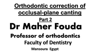 Faculty of Dentistry
Mansoura Egypt
Dr Maher Fouda
Professor of orthodontics
Orthodontic correction of
occlusal-plane canting
Part 2
 