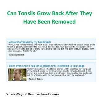Can Tonsils Grow Back After They
Have Been Removed
5 Easy Ways to Remove Tonsil Stones
 