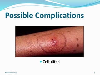 Possible Complications
 Cellulites
8 December 2015 7
 