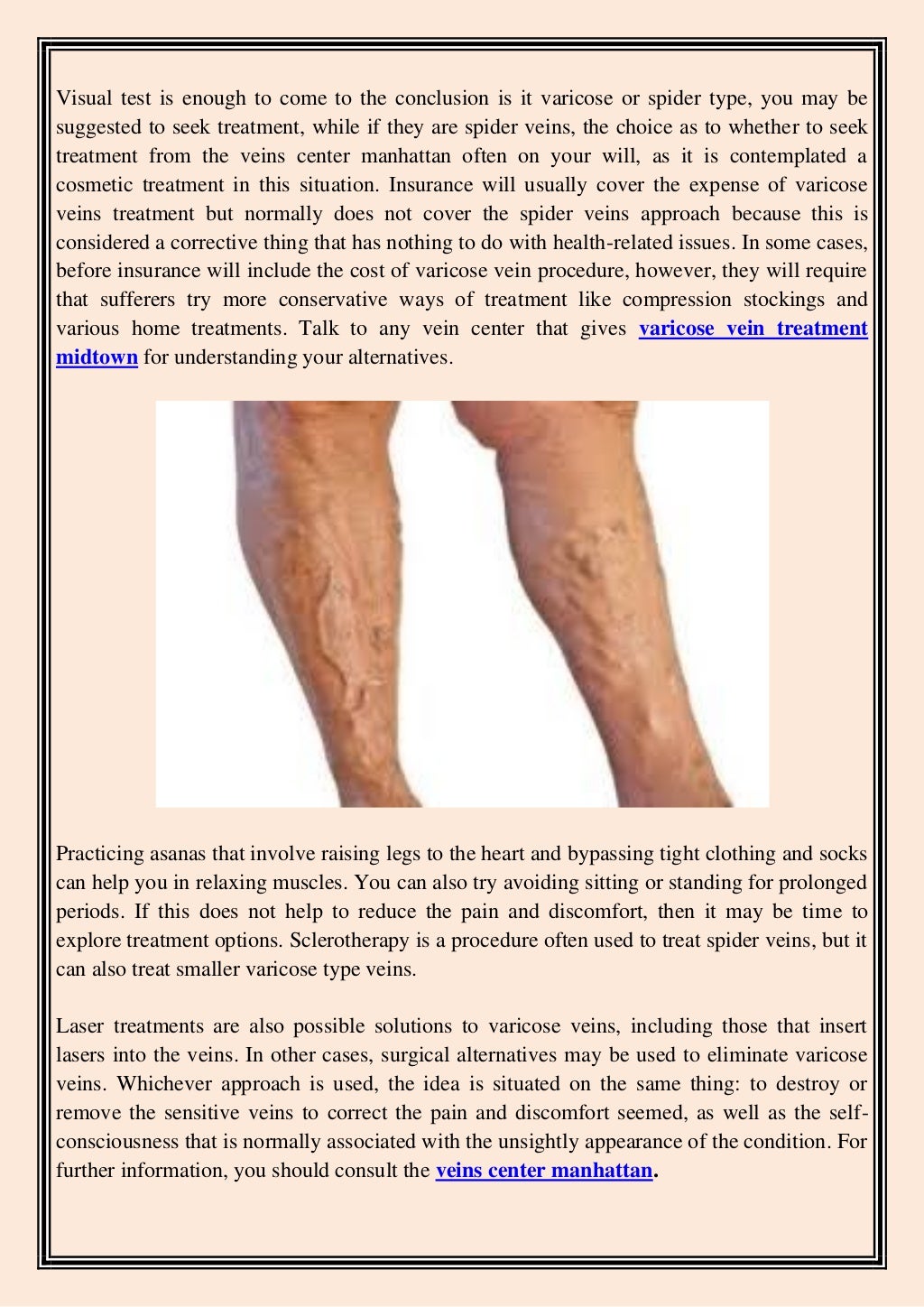Can vein issues have serious consequences
