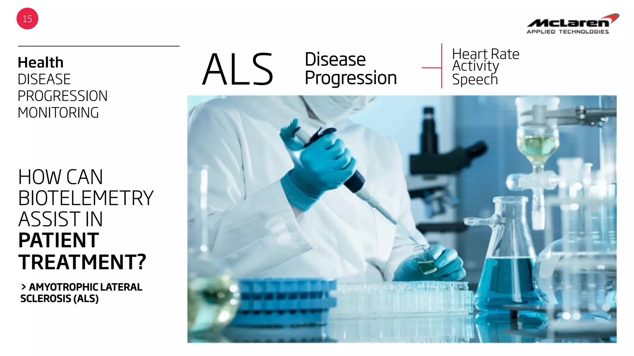 Health
DISEASE
PROGRESSION
MONITORING
15
HOW CAN
BIOTELEMETRY
ASSIST IN
PATIENT
TREATMENT?
> AMYOTROPHIC LATERAL
SCLEROSIS (ALS)
ALS Disease
Progression
Heart Rate
Activity
Speech
 