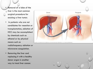 Cancer of liver - Easy ppt for Student Nurses