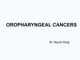 OROPHARYNGEAL CANCERS
Dr. Ayush Garg
 