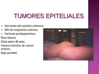 LisasMALIGNASBilaterales