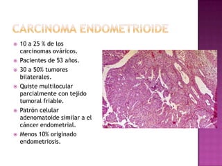 CANCER DE OVARIO% DE TODASNEOPLASIASTIPO%BILATERAL SEROSO...........................................40253065BENIGNO(60%)BORDERLINE(15%)MALIGNO (25%)MUCINOSO....................................10BENIGNO(80%)BORDERLINE(10%)MALIGNO (10%)51020