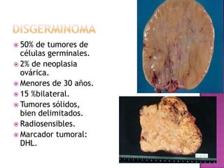 DispareuniaAscitis (Mt intestinales)Distensión abdominalFlatulenciaEstreñimientoNaúseasAnorexiaSaciedad tempranaMenstruación irregular o hemorragia vaginal.