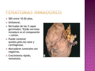 Vias de diseminaciónExtensión directa