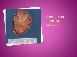 Exfoliación intraperitonealDiagnóstico precoz1. USG TRANSVAGINAL riesgo neoplásico:Tamaño del tumor. 