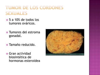 Heteroecogenicidad (sólido quístico). 