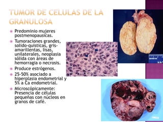 Crecimiento endo y exofítico (excrecencias papilares intraquísticas o extraquísticas) 