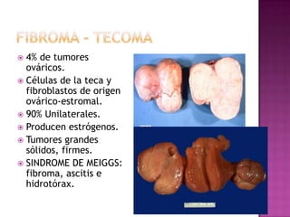 Componente sólido tumoral. 