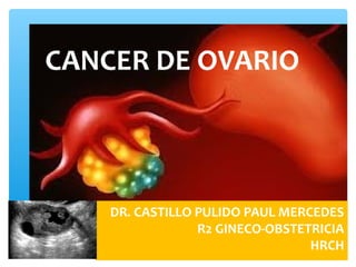 DR. CASTILLO PULIDO PAUL MERCEDES
R2 GINECO-OBSTETRICIA
HRCH
CANCER DE OVARIO
 