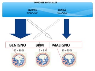BENIGNO BPM MALIGNO
70 – 80 % 2 – 3 % 20 – 25 %
QUISTES CLINICA
HALLAZGO HALLAZGO
E.P .
TUMORES EPITELIALES
 