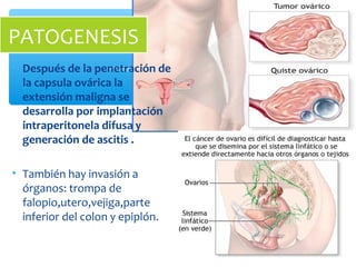 • Después de la penetración de
la capsula ovárica la
extensión maligna se
desarrolla por implantación
intraperitonela difusa y
generación de ascitis .
• También hay invasión a
órganos: trompa de
falopio,utero,vejiga,parte
inferior del colon y epiplón.
PATOGENESIS
 