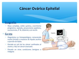 ∗ Ecografía:
∗ Masa compleja, solido quística, crecimiento
progresivo, septada, proyecciones papilares,
excrecencias, IP , bilateral y con ascitis
∗ Ca 125:
∗ Diagnóstico es histopatológico, removiendo
ovario (inicial) o muestras de liquido ascítico
o porción de tejido.
∗ Elevado en 50% de los cáncer confinados al
ovario y >85% en cáncer avanzado.
∗ Elevado en otras condiciones benignas o
malignas
Cáncer Ovárico Epitelial
 