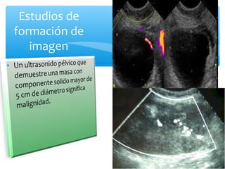 Estudios de
formación de
imagen
 