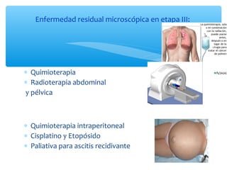∗ Quimioterapia
∗ Radioterapia abdominal
y pélvica
∗ Quimioterapia intraperitoneal
∗ Cisplatino y Etopósido
∗ Paliativa para ascitis recidivante
Enfermedad residual microscópica en etapa III:
 