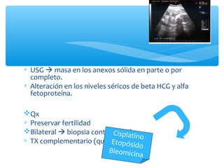 ∗ USG  masa en los anexos sólida en parte o por
completo.
∗ Alteración en los niveles séricos de beta HCG y alfa
fetoproteína.
Qx
∗ Preservar fertilidad
Bilateral  biopsia contralateral
∗ TX complementario (quimioterápico)
Cisplatino
Etopósido
Bleomicina
 