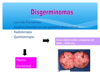 ∗ Los más frecuentes
∗ Mujeres fenotípicas con gónadas disgenéticas
∗ Radioterapia
∗ Quimioterapia
Dosis abdominales completas de
2000 – 2500 cGy
Platino
(Fertilidad)
 