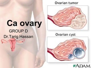 Ca ovary GROUP D Dr.Tarig Hassan 