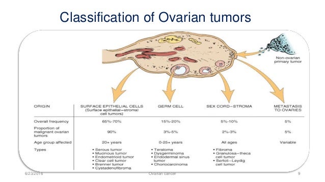 Ovarian Tumor Size Chart